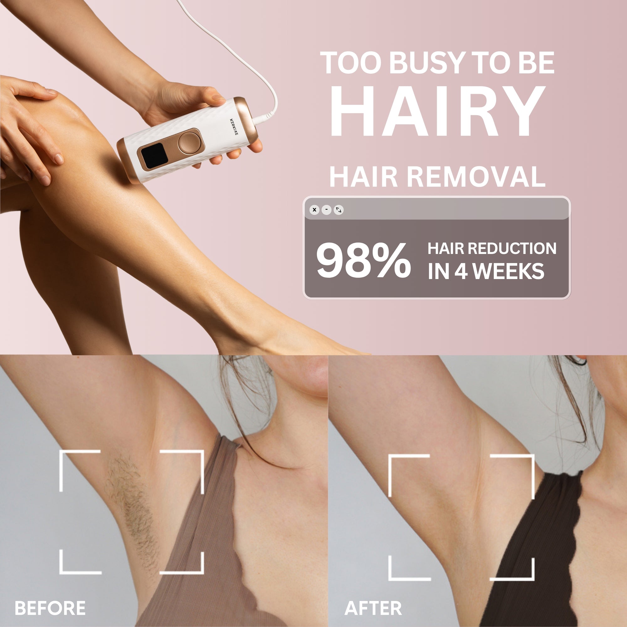 Keskine IPL Hair Removal Handset